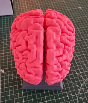 3D printed human brain halves detached showing internal structures like the corpus callosum