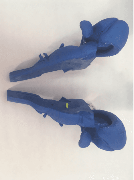 Brainstem two